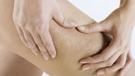 Cellulite, piccole regole per combatterla