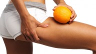 Cellulite, tutta colpa degli Ages!