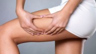 Un nuovo laser contro la cellulite 