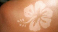 Sunburn art, il tatuaggio solare fa male!