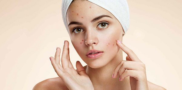 acne_rughe